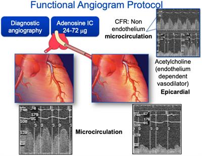 Imaging Assessment of Endothelial Function: An Index of Cardiovascular Health